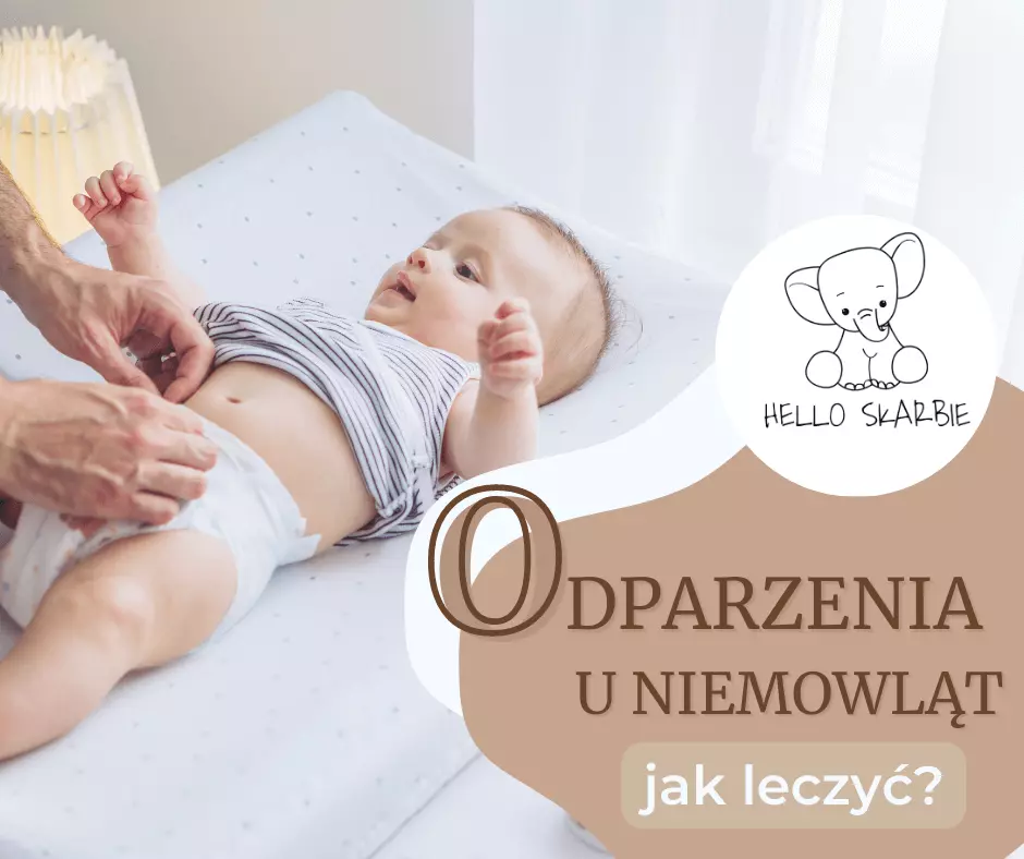 odparzenia u niemowląt dziecko w pampersie dziecko w pieluszce jak leczyć odparzenia jak zapobiegać odparzeniom